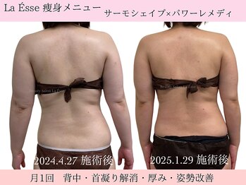 ラエッセ(La Esse)/月1回のメンテナンス