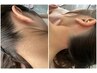 【シュガーリング】うなじWAX脱毛※女性専用