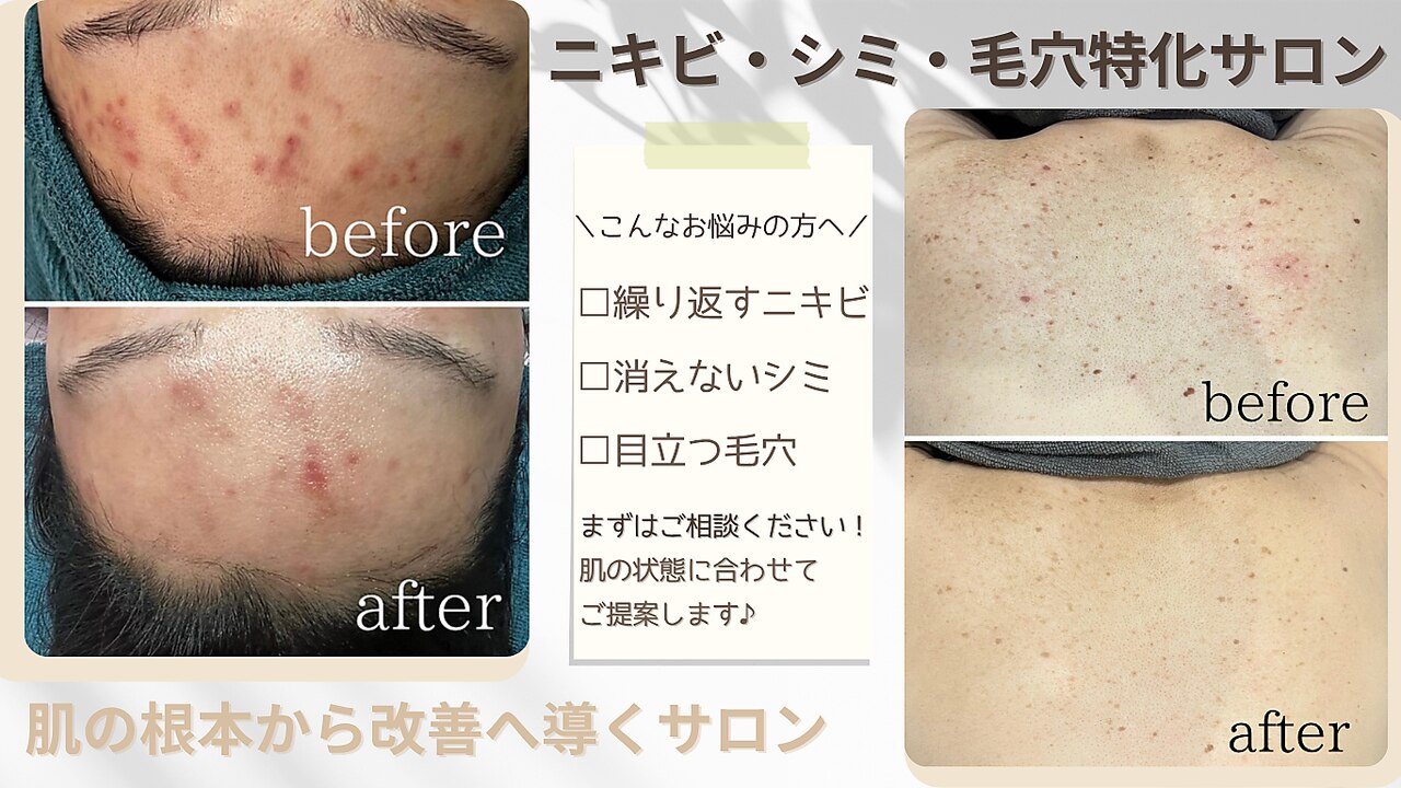 シエル(Ciel)｜ホットペッパービューティー