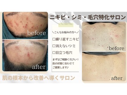 シエル(Ciel)の写真