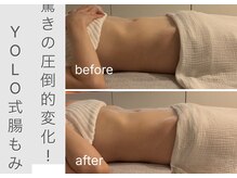 エスティーアンドユー(st&U)/便通でお悩みのお客様