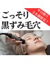 【平日3名様限定】ごっそり毛穴吸引!溜まった角質をケアして透明美肌♪