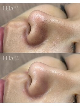 オーリエ 中目黒(Aurie)の写真/【AI肌診断×丁寧なカウンセリング】一人ひとりの肌状態に合わせたオーダーメイド肌管理