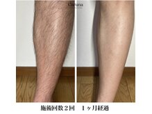 カルナ(Caruna)/男性ご新規様、受付一時停止中