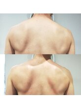 RiとBiのたまご/上半身マッサージ２回