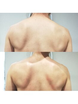 RiとBiのたまご/上半身マッサージ２回