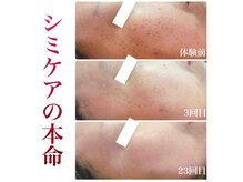 ブランシェ 高岡店 × 椿