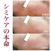 ブランシェ 高岡店 × 椿