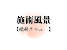 アキュレ(Acure)/痩身メニュー