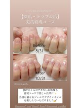 モナールアンド(MONNAL&)/【深爪・トラブル爪】美爪育成