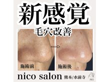 ニコサロン(nico salon)の雰囲気（毛穴の黒ずみ、毛穴の開き、くすみに◎ニキビケアやしみケアにも）