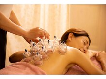 こいわ鍼灸院ハリコア(HARICORE)/鍼灸+カッピングで血流改善