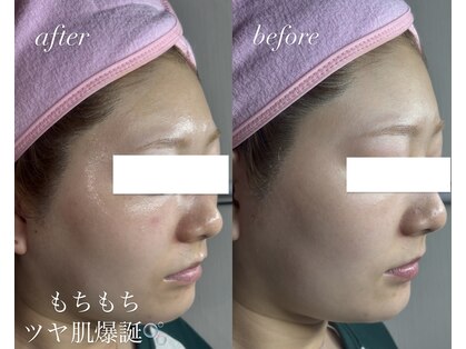 ベイビースキン(Baby skin)の写真