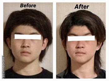 ショウフェイスデザイン(Sho Face Design)/《小顔矯正》ビフォーアフター