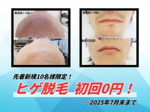 ダイアモンドベリー