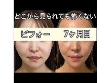 ココ(COCO)
