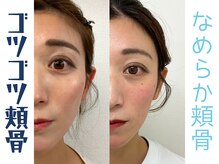 ナチュラルパーフェクトフェイス 新宿の雰囲気（頬骨の歪みは女性の一生のお悩み！改善するだけで印象改善[渋谷]）