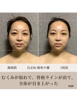 エレーニ 麻布十番(ELENI)/骨格らいんが欲しがる