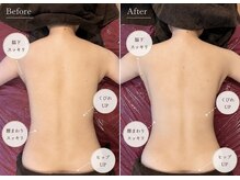 ルーチェスト(Lucest)の雰囲気（お一人おひとりに合わせた高周波温熱ラフォスオーダーメイド施術）