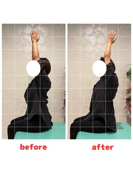 ナオル整体 福岡香椎院(NAORU整体)/40代女性施術事例【肩のだるさ】