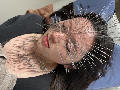 葵の葉鍼灸院の写真