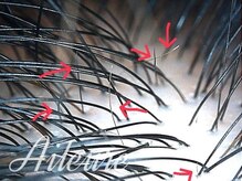 エルール トータルビューティ(Aileure total beauty)/育毛促進ケア