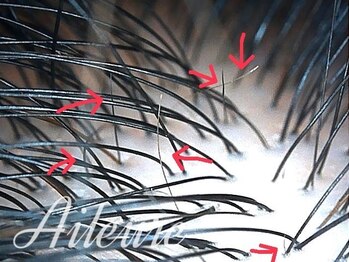 エルール トータルビューティ(Aileure total beauty)/育毛促進ケア