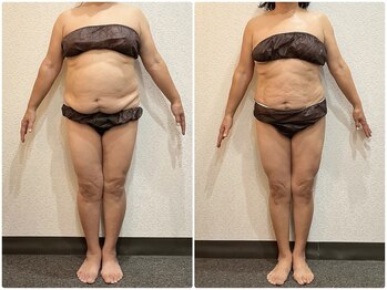 ウェリナ平和堂長久手院/小顔矯正/骨盤矯正/痩身/整体