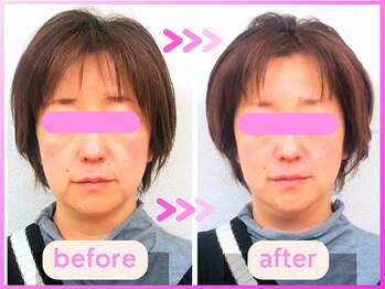 ホリハ整体院/*Before&After* 美顔デザイン