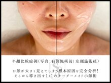 韓国肌管理室 ソア(soa)/【SOAオリジナル小顔セット】