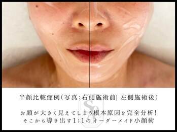 韓国肌管理室 ソア(soa)/【SOAオリジナル小顔セット】