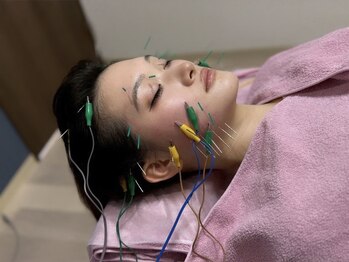 サロン ド ハリッシュ(Salon de HARISH)の写真/≪立体造顔◆電気美容鍼60本[ヘッド込]50分¥5980≫速攻実感！フェイスラインをしっかり引き上げたるみケア