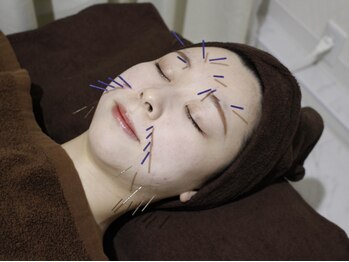 美リレアの写真/本格技術が人気の秘訣☆《人気No.1【歯ぎしり・食いしばり改善】美容鍼×小顔矯正で左右差スッキリ》¥9980