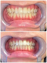 アトリエ/回数券10枚使用☆有効期限なし☆