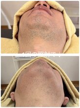 ティアレ 廿日市店(Tiare)/