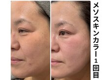 エイジングケアサロンシー(aging care salon cee)の雰囲気(肌質もたるみも一気に改善!)
