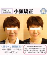 RKY/小顔矯正&頭蓋骨矯正4回（40代）