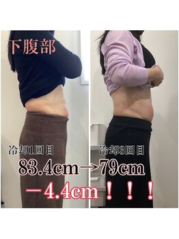 アモ(amo)/気になるポッコリお腹