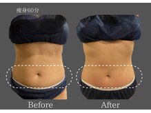 クレビア 麻布十番(CREBIA)/【痩身/代謝促進】