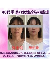 ハナノ整体院/下腹が引き上がった腰回すっきり