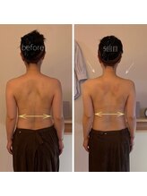 パル コルギサロン(Pal. Korugi salon)/コルギビフォーアフター