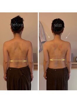 パル コルギサロン(Pal. Korugi salon)/コルギビフォーアフター