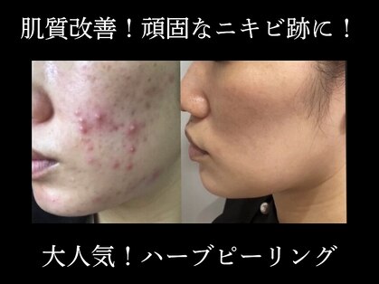 ウィズサロン(withサロン)の写真