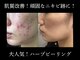ウィズサロン(withサロン)の写真