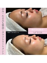 シェリエ(Sheller)/タラソトリートメン