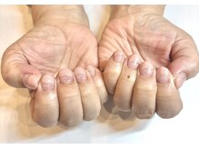 アールエム(Rm)/2月◇ネイル