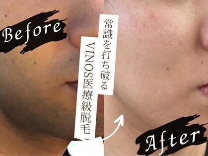 ビノス 金沢店(VINOS)の写真