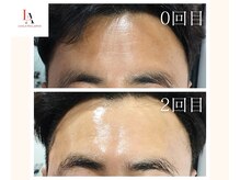 ウィウィ(oui-oui `)/剥離なしララピール