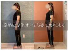 コリや痛みの改善と同時に、自然と綺麗な立ち姿勢に。