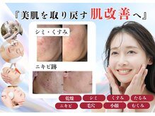 ユニクリア(Uni clear)